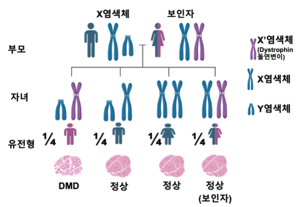 DMD의 보편적인 유전 패턴을 나타낸 가계도