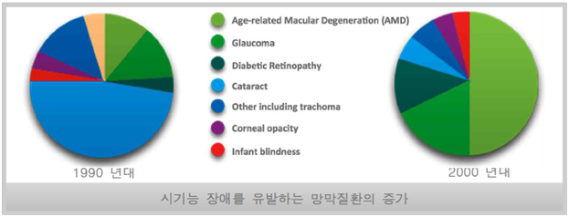 시기능 장애를 유발하는 망막질환의 증가 이미지