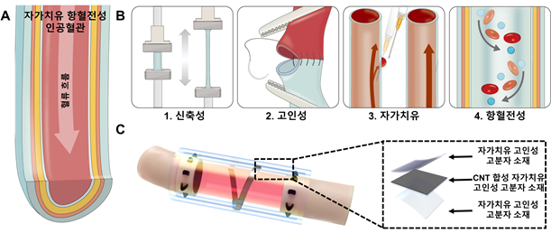 인공혈관을 유막 코팅? 심혈관 질환 재발 막는다