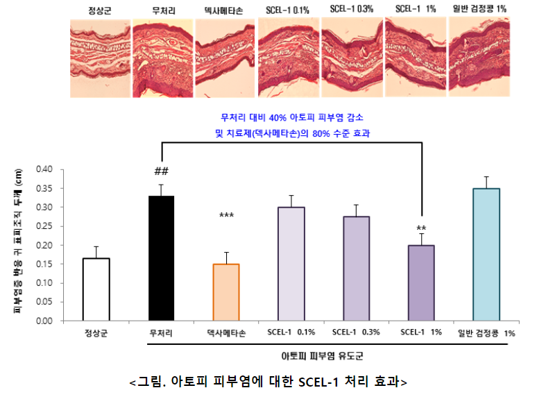 캡처.PNG